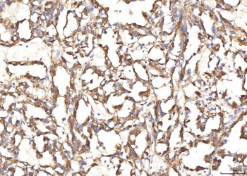 Anti-BHMT Antibody