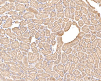 Anti-BHMT Antibody
