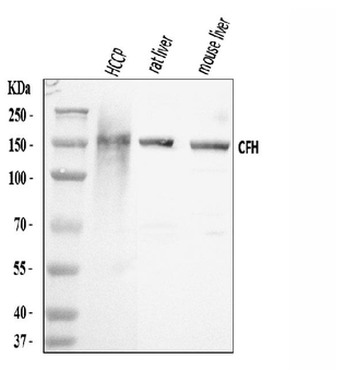 Anti-Factor H/CFH Antibody