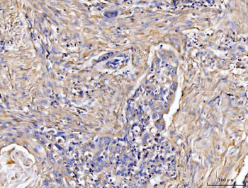 Anti-COL6A1 Antibody
