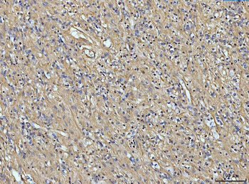 Anti-COL6A1 Antibody