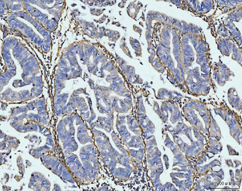Anti-COL6A1 Antibody
