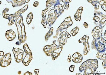 Anti-COL6A1 Antibody