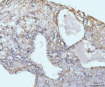 Anti-COL6A1 Antibody