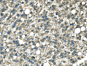 Anti-DROSHA Antibody