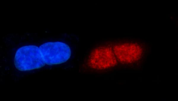 Anti-ERCC1 Antibody