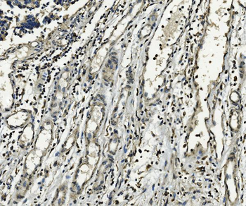 Anti-XPD/ERCC2 Antibody