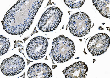 Anti-XPD/ERCC2 Antibody
