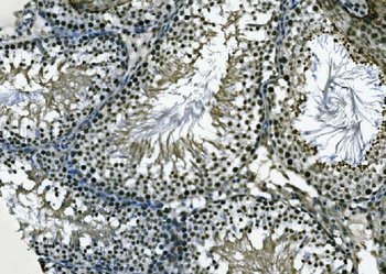 Anti-XPD/ERCC2 Antibody
