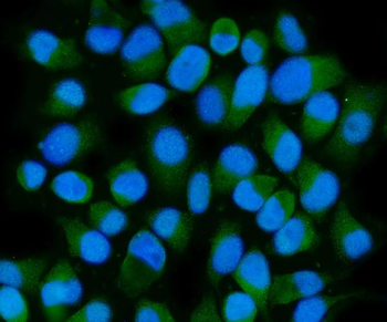 Anti-HSPA6 Antibody
