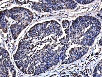 Anti-HSPA6 Antibody
