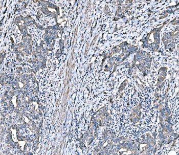 Anti-HSPA6 Antibody