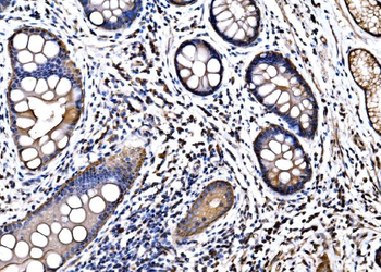 Anti-HSPA6 Antibody