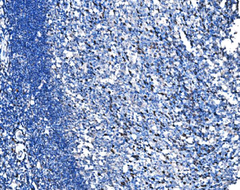 Anti-HSPA6 Antibody