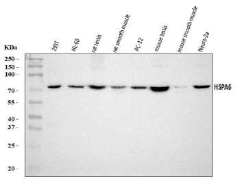 Anti-HSPA6 Antibody