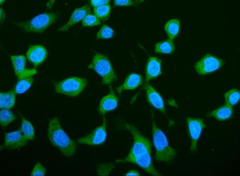 Anti-LARP1 Antibody