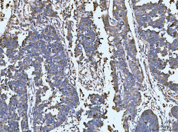 Anti-LARP1 Antibody