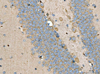 Anti-LARP1 Antibody