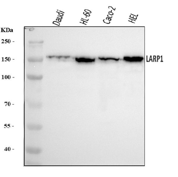 Anti-LARP1 Antibody