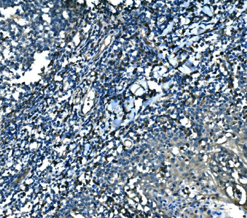 Anti-MEF2B Antibody