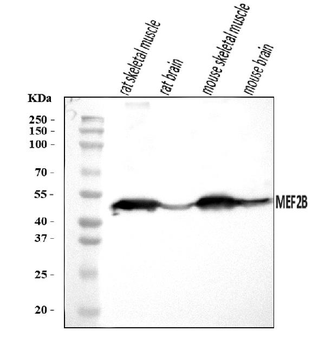 Anti-MEF2B Antibody