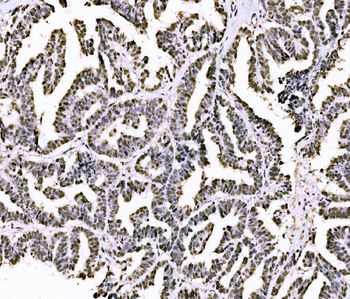 Anti-PIWIL4/PIWI Antibody