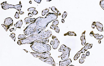 Anti-PIWIL4/PIWI Antibody