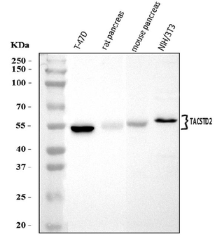 Anti-TROP2/TACSTD2 Antibody