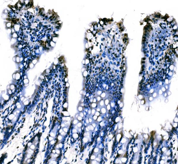 Anti-splicing factor 1 Antibody (monoclonal, 7D9E3)