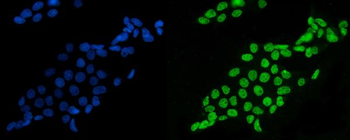 Anti-splicing factor 1 Antibody (monoclonal, 7D9E3)