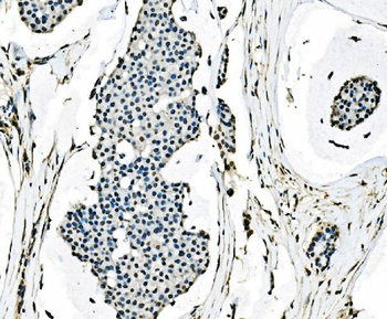Anti-splicing factor 1 Antibody (monoclonal, 7D9E3)