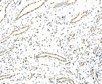 Anti-splicing factor 1 Antibody (monoclonal, 7D9E3)