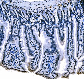 Anti-splicing factor 1 Antibody (monoclonal, 2F5D10)