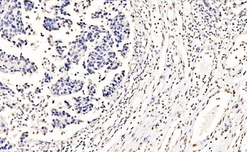 Anti-splicing factor 1 Antibody (monoclonal, 2F5D10)