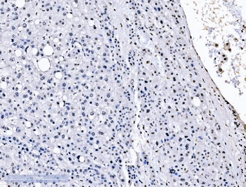 Anti-splicing factor 1 Antibody (monoclonal, 2F5D10)