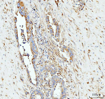 Anti-Grp75 Antibody (monoclonal, 4I9)