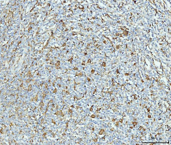 Anti-Grp75 Antibody (monoclonal, 4I9)