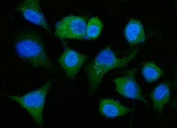 Anti-ALDH1A1 Antibody (monoclonal, 4C3)