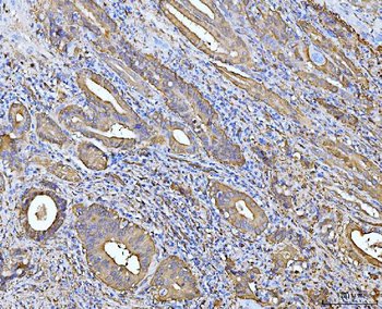Anti-ALDH1A1 Antibody (monoclonal, 4C3)