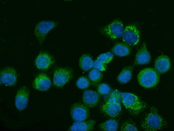 Anti-Glutaminase/GLS Antibody (monoclonal, 3G13)