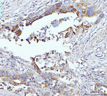 Anti-Glutaminase/GLS Antibody (monoclonal, 3G13)