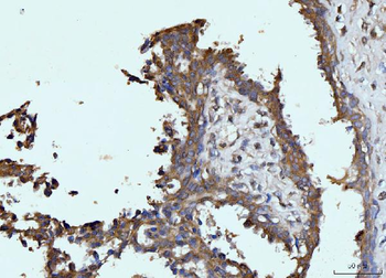 Anti-Glutaminase/GLS Antibody (monoclonal, 3G13)