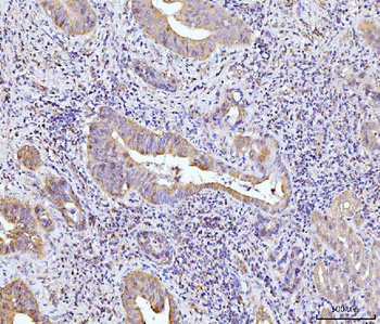 Anti-Glutaminase/GLS Antibody (monoclonal, 3G13)