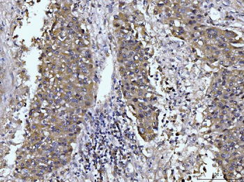 Anti-Glutaminase/GLS Antibody (monoclonal, 3G13)
