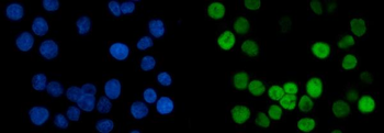 Anti-MCM6 Antibody (monoclonal, 3I4C8)
