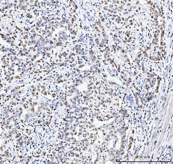 Anti-MCM6 Antibody (monoclonal, 3I4C8)