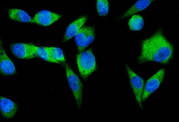 Anti-SND1 Antibody (monoclonal, 5F5E9)