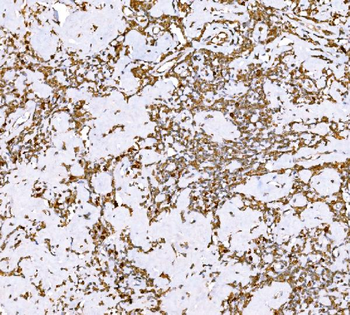 Anti-SND1 Antibody (monoclonal, 5F5E9)