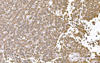 Anti-SND1 Antibody (monoclonal, 5F5E9)