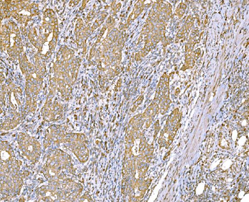Anti-SND1 Antibody (monoclonal, 5F5E9)